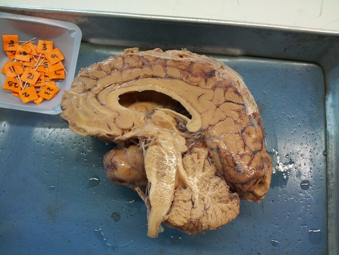 human brain.jpg